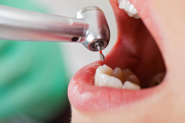 Best Orthodontic Emergency Dentist in Dooms, VA